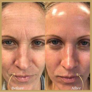 Magic Facelift in Islamabad