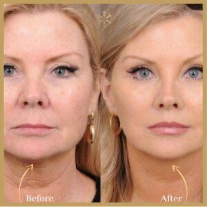 Magic Facelift in Islamabad
