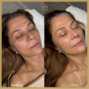 Magic Facelift in Islamabad