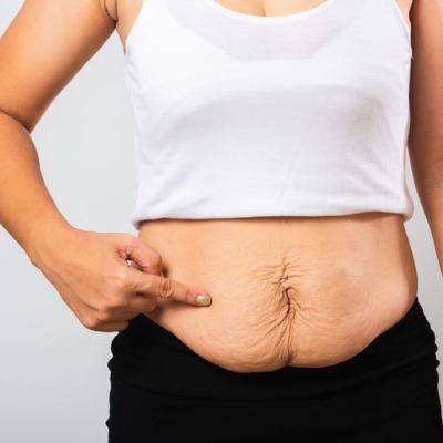 What is the Average Cost of Saggy Skin Treatment in Islamabad