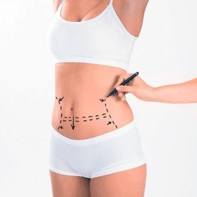 What should I look for in a liposuction surgeon