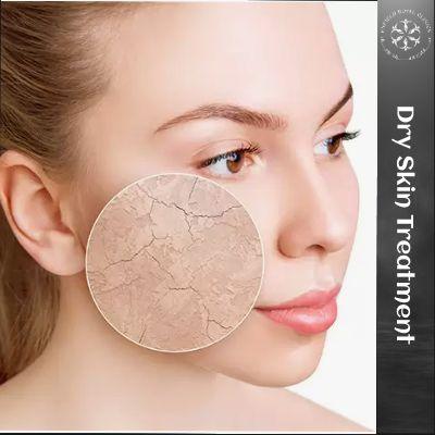 dry skin treatment in Islamabad