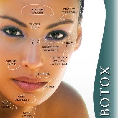 Botox Injection in Islamabad, Cost, Benefits and Best Clinics