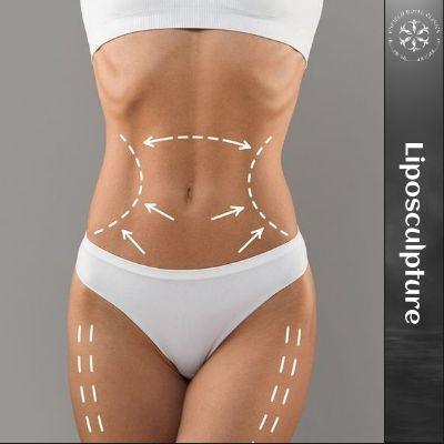 High Definition Liposculpture in Islamabad