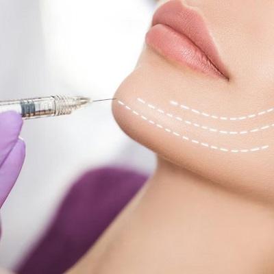 How Much Does Kybella Treatment Cost in Islamabad