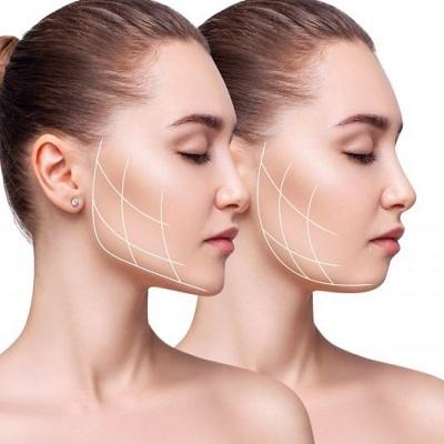 What Happens If I Gain Weight After Buccal Fat Removal