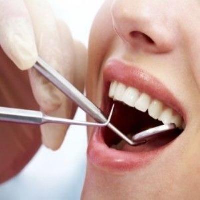 Where to Find the Best Teeth Scaling Prices in Islamabad
