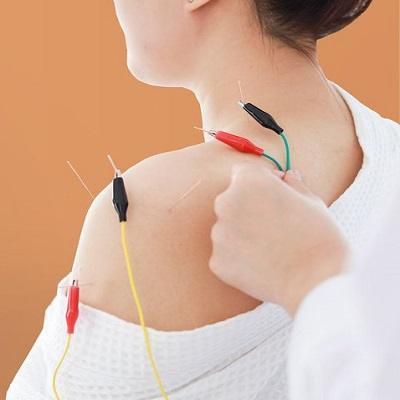Acupuncture Treatment in Islamabad