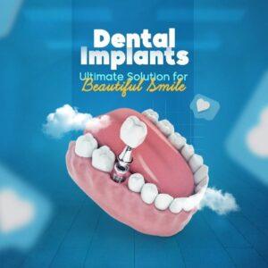 Are Dental Implants in Islamabad Safe and Reliable