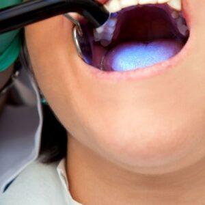 Do fillings hurt without an injection