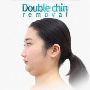 How Do I Know If I Am a Candidate for Chin Reduction in Islamabad?