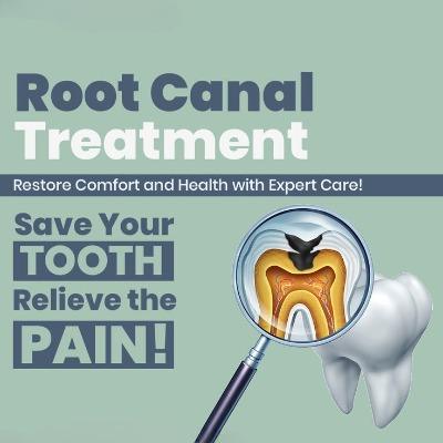 Is It Better to Get a Root Canal or Remove the Tooth Completely in Islamabad