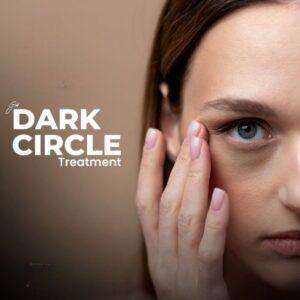 Medical and Natural Treatments for Dark Circles Which Is Best