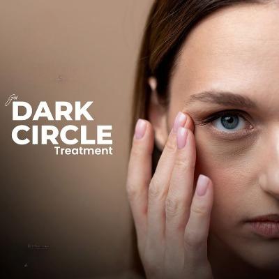 Medical and Natural Treatments for Dark Circles Which Is Best