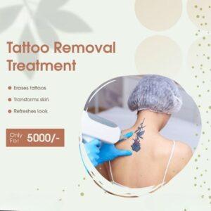 What Makes Q-Switched Lasers Popular for Tattoo Removal in Islamabad