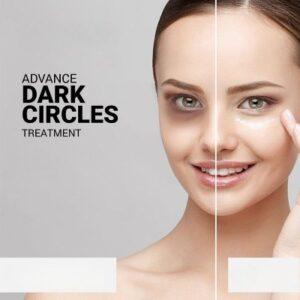 Why Do Dark Circles Form and How Can They Be Treated in Islamabad