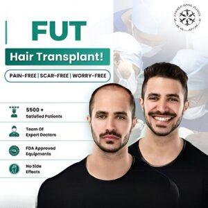 Why Do Some Patients Prefer FUT Over FUE in Islamabad
