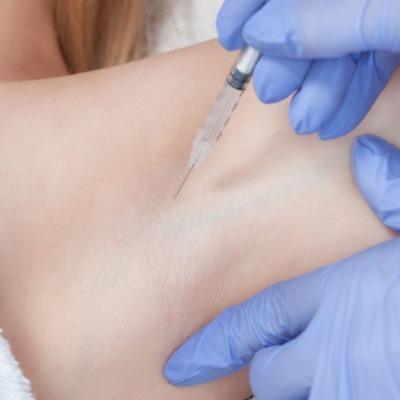 What Should I Avoid After Getting Botox for Sweating in Islamabad