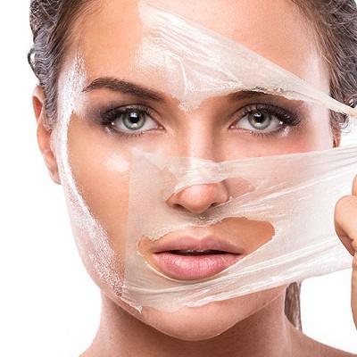Chemical skin peel treatment in Islamabad Pakistan