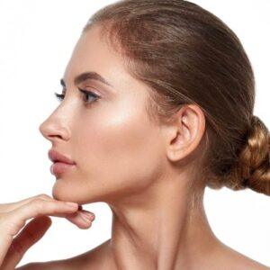 Do Jawline Fillers Migrate