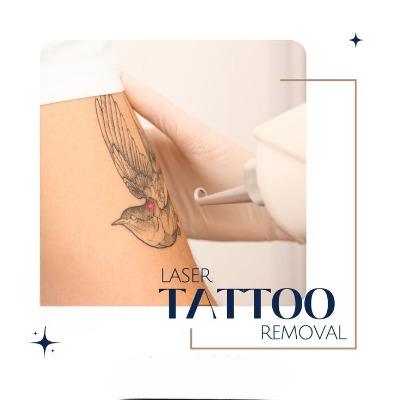 Does Pico Sure in Islamabad work for faded or partial tattoos