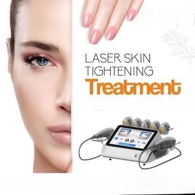 Laser Skin Tightening in Islamabad