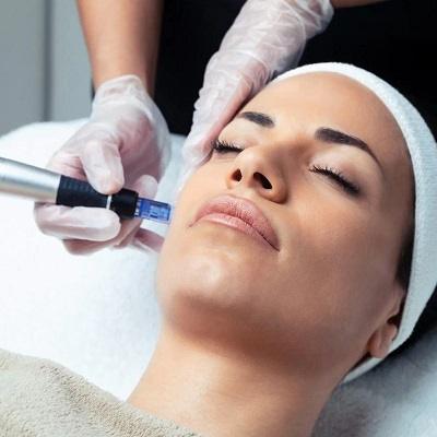 Mesotherapy for Face and Skin in Islamabad