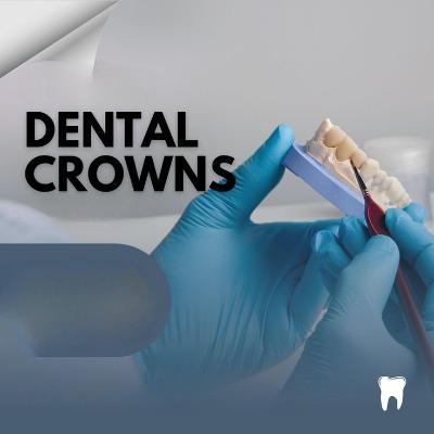 What Are the Signs You Might Need a Dental Crown in Islamabad