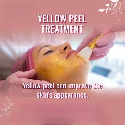 What Ingredients Are Used in Yellow Peel in Islamabad Clinics