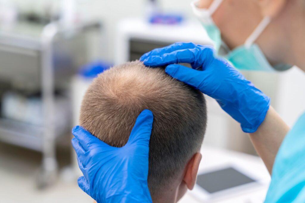 What is Hair Transplaant in Islamabad Pakistan?