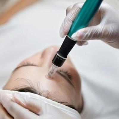 How Does Mesotherapy Work for Anti-Aging in Islamabad