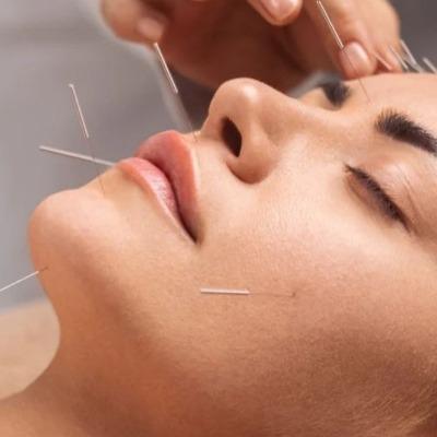 Is acupuncture good for your face