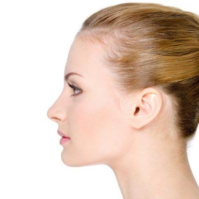 Can You Avoid Braces with Jaw Surgery in Islamabad