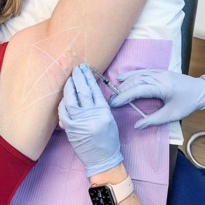Hyperhidrosis treatment in islamabad