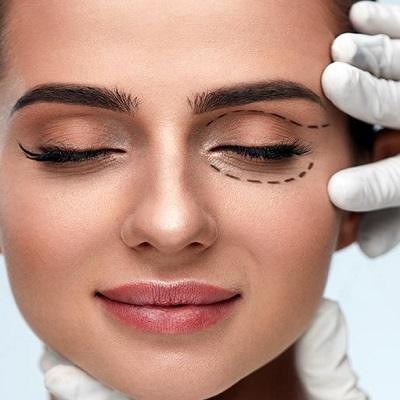 Is there any timeline for blepharoplasty