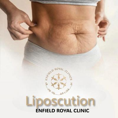 Liposuction in Islamabad