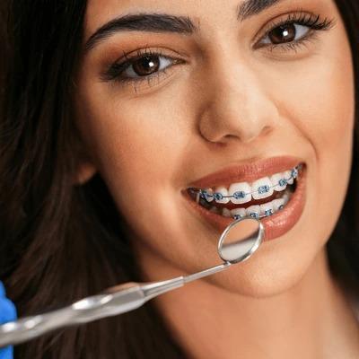 Can dental braces close gaps between teeth
