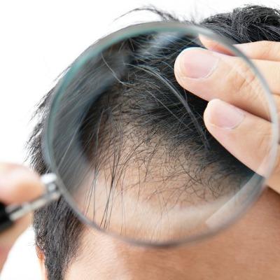 Does Stem Cell Hair Therapy Work Faster Than Other Treatments