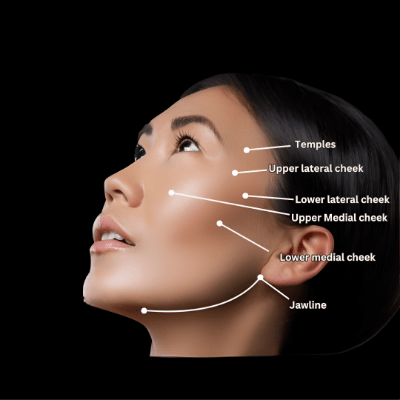 How Does Juvederm Differ from Other Filler Brands in Results