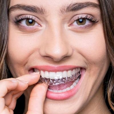 Invisible Braces Cost in Islamabad