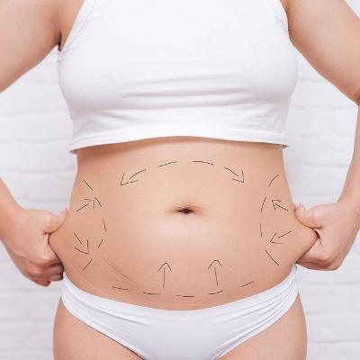 Non-Surgical Fat removal in Islamabad