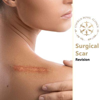Surgical Scar Revision in Islamabad