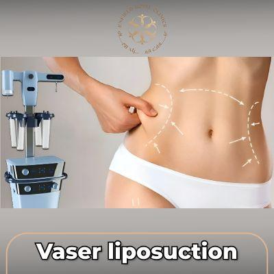 Vaser Liposuction in Islamabad