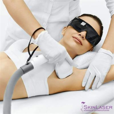 What does skin feel like after Laser Hair Removal