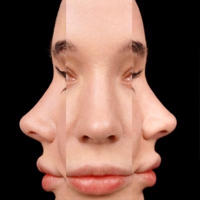 How to Find a Qualified Rhinoplasty Doctor in Islamabad