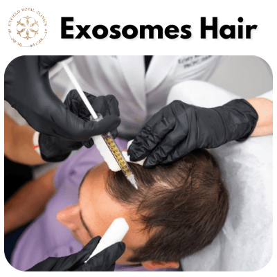 What are the benefits of exosomes for hair