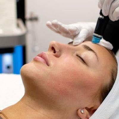 Is Hydrafacial Good for Oily Skin
