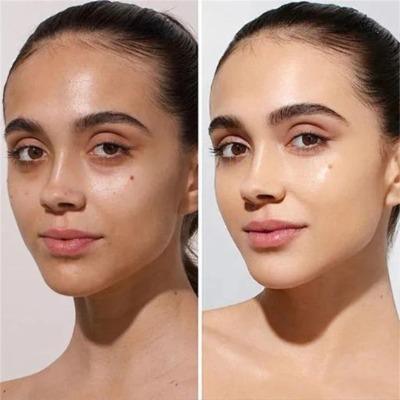 Skin Whitening Treatment Cost in Islamabad