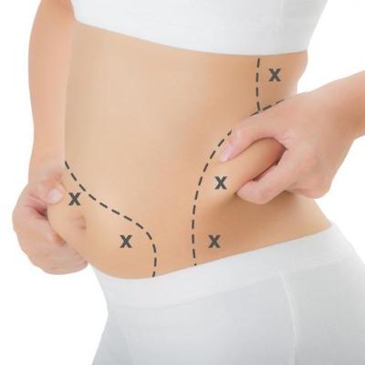 What Anesthesia Is Used in Liposuction?