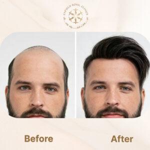 hair wig after before